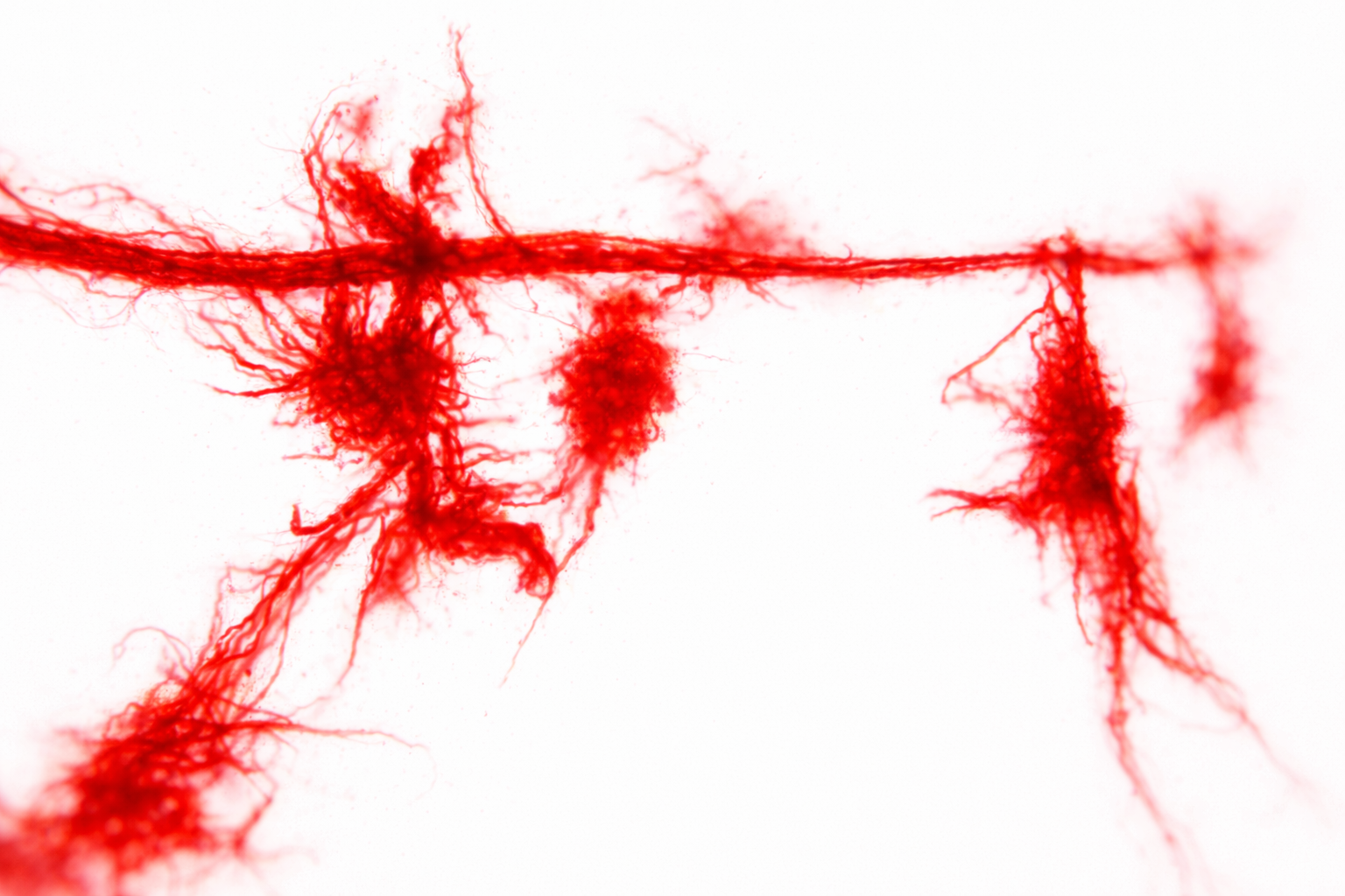 Série : micropollute – Image 6