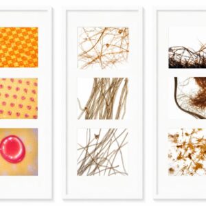 Série : micropollute